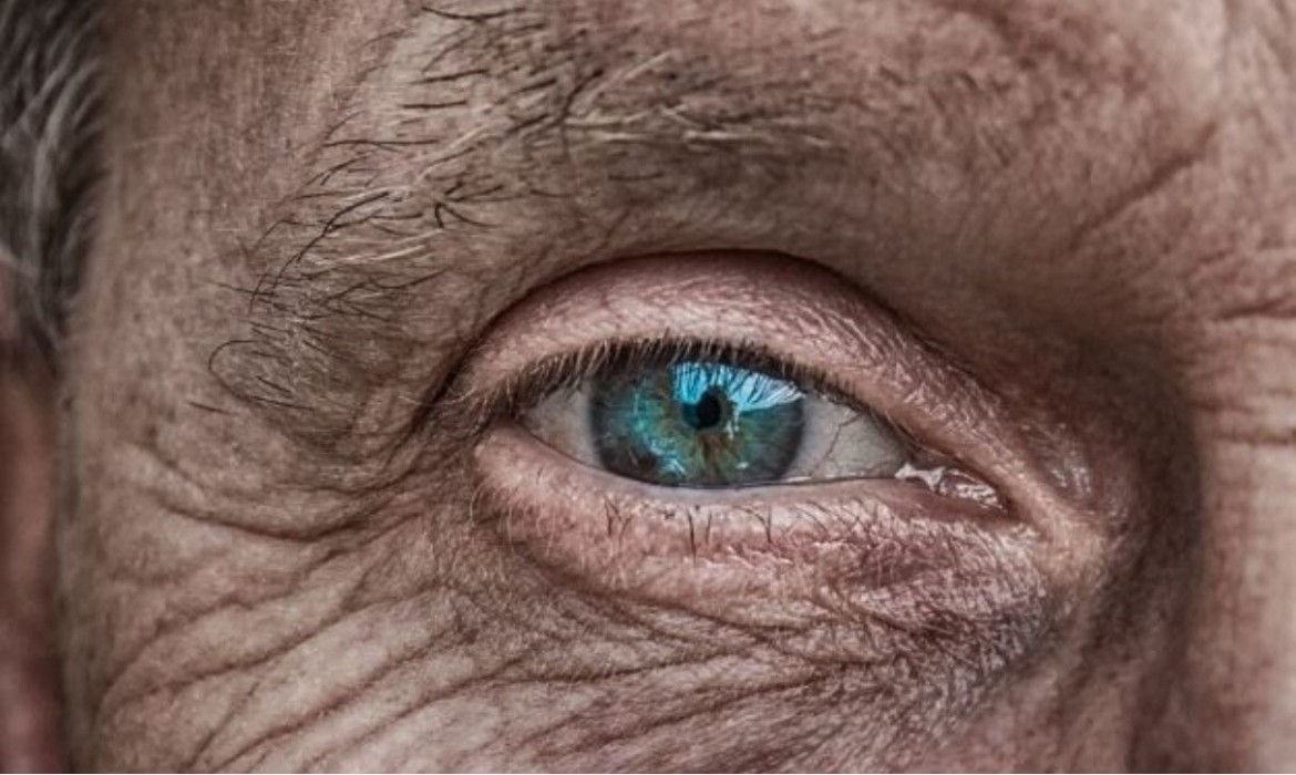 Glaucoma ocular: lo que debes saber de la principal causa de ceguera en el mundo